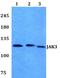 Janus Kinase 3 antibody, A02598-2, Boster Biological Technology, Western Blot image 