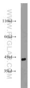 Actin Alpha 2, Smooth Muscle antibody, 23081-1-AP, Proteintech Group, Western Blot image 