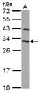 Charged multivesicular body protein 2b antibody, NBP2-15886, Novus Biologicals, Western Blot image 