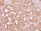 Rac Family Small GTPase 2 antibody, GTX113262, GeneTex, Immunohistochemistry paraffin image 