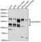 Calcium Voltage-Gated Channel Auxiliary Subunit Alpha2delta 1 antibody, LS-C750232, Lifespan Biosciences, Western Blot image 