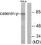 Junction Plakoglobin antibody, LS-B6046, Lifespan Biosciences, Western Blot image 