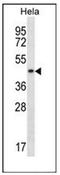 DnaJ Heat Shock Protein Family (Hsp40) Member A3 antibody, AP51285PU-N, Origene, Western Blot image 