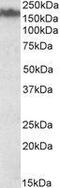 Neurofilament Medium antibody, GTX88324, GeneTex, Western Blot image 