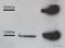 Collagen Type III Alpha 1 Chain antibody, ab6310, Abcam, Western Blot image 