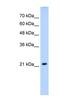 Solute Carrier Family 25 Member 14 antibody, NBP1-59598, Novus Biologicals, Western Blot image 