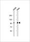Nuclear Receptor Subfamily 3 Group C Member 1 antibody, 60-740, ProSci, Western Blot image 