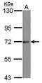 Protein Kinase D3 antibody, PA5-30729, Invitrogen Antibodies, Western Blot image 