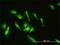 Zinc Finger Protein 174 antibody, H00007727-M01, Novus Biologicals, Immunocytochemistry image 
