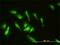 Zinc Finger Protein 174 antibody, H00007727-M01, Novus Biologicals, Immunocytochemistry image 
