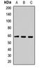 TSPY Like 1 antibody, LS-C668655, Lifespan Biosciences, Western Blot image 