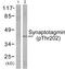 Synaptotagmin 1 antibody, LS-C199628, Lifespan Biosciences, Western Blot image 