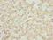 ArfGAP With SH3 Domain, Ankyrin Repeat And PH Domain 3 antibody, LS-C399827, Lifespan Biosciences, Immunohistochemistry frozen image 