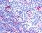Neuroepithelial Cell Transforming 1 antibody, PA5-18217, Invitrogen Antibodies, Immunohistochemistry paraffin image 