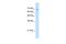 Transmembrane 9 Superfamily Member 1 antibody, PA5-42621, Invitrogen Antibodies, Western Blot image 