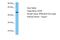 Creatine Kinase, Mitochondrial 2 antibody, A30140, Boster Biological Technology, Western Blot image 