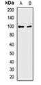 WW Domain Containing E3 Ubiquitin Protein Ligase 2 antibody, LS-C668276, Lifespan Biosciences, Western Blot image 