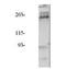 Insulin Receptor Substrate 2 antibody, GTX23690, GeneTex, Immunoprecipitation image 