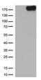 NPHS1 Adhesion Molecule, Nephrin antibody, CF813414, Origene, Western Blot image 