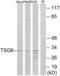 TNF Alpha Induced Protein 6 antibody, LS-C199694, Lifespan Biosciences, Western Blot image 