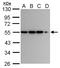 Calcium/Calmodulin Dependent Protein Kinase IG antibody, GTX107499, GeneTex, Western Blot image 