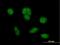 Zinc Finger HIT-Type Containing 6 antibody, H00054680-B01P, Novus Biologicals, Immunocytochemistry image 