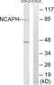 Non-SMC Condensin I Complex Subunit H antibody, abx014390, Abbexa, Western Blot image 