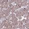 Mitochondrial Ribosomal Protein S9 antibody, PA5-61750, Invitrogen Antibodies, Immunohistochemistry frozen image 