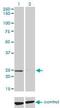 Nudix Hydrolase 5 antibody, H00011164-M04, Novus Biologicals, Western Blot image 