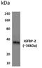 Insulin Like Growth Factor Binding Protein 2 antibody, GTX52794, GeneTex, Western Blot image 