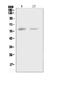 Colony Stimulating Factor 1 antibody, A00620-3, Boster Biological Technology, Western Blot image 