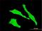 Trans-Golgi Network Protein 2 antibody, H00010618-M02, Novus Biologicals, Immunocytochemistry image 