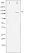 Protein Kinase D1 antibody, GTX52375, GeneTex, Western Blot image 