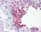 ADP-Ribosyltransferase 3 antibody, 51-425, ProSci, Immunohistochemistry paraffin image 