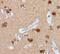 Nucleolin antibody, PA5-19508, Invitrogen Antibodies, Immunohistochemistry paraffin image 