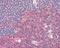 Pyruvate Kinase M1/2 antibody, 49-933, ProSci, Immunohistochemistry frozen image 