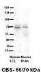 Cystathionine-Beta-Synthase antibody, TA338394, Origene, Western Blot image 
