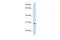 ST3 Beta-Galactoside Alpha-2,3-Sialyltransferase 3 antibody, PA5-42912, Invitrogen Antibodies, Western Blot image 