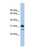 RAP1B, Member Of RAS Oncogene Family antibody, NBP1-54871, Novus Biologicals, Western Blot image 