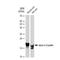 Crystallin Alpha A antibody, GTX03188, GeneTex, Western Blot image 