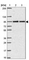 Tetratricopeptide repeat protein 7B antibody, NBP2-31782, Novus Biologicals, Western Blot image 