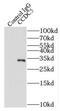 HAUS Augmin Like Complex Subunit 1 antibody, FNab01358, FineTest, Immunoprecipitation image 