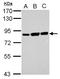 Ezrin antibody, NBP2-16396, Novus Biologicals, Western Blot image 