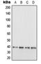 Microtubule Associated Protein RP/EB Family Member 3 antibody, LS-C353325, Lifespan Biosciences, Western Blot image 