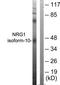 Sphingosine-1-Phosphate Receptor 5 antibody, TA311659, Origene, Western Blot image 