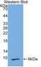 Peptidase Inhibitor 3 antibody, abx132067, Abbexa, Western Blot image 