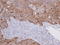 Isopentenyl-Diphosphate Delta Isomerase 1 antibody, LS-C185762, Lifespan Biosciences, Immunohistochemistry paraffin image 