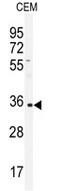 Immunoglobulin Heavy Constant Alpha 1 antibody, AP14104PU-N, Origene, Western Blot image 