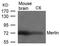 Neurofibromin 2 antibody, GTX50579, GeneTex, Western Blot image 