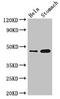 GDNF Family Receptor Alpha Like antibody, LS-C399399, Lifespan Biosciences, Western Blot image 